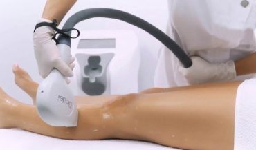💡 Laser Hair Removal for Hormonal Imbalance